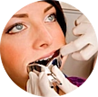 Bei Ihrem Zahnarzt können Sie Zahnabdrücke oder Gipsmodelle anfertigen lassen.