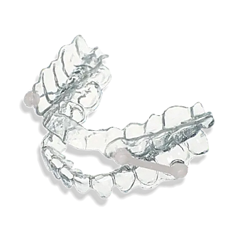 Die individuell angepaßte Silensor Schnarchschiene ist Gold-Standard in der Schnarchtherapie